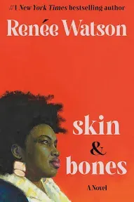 Skin &amp; Bones (Hardback or Cased Book)